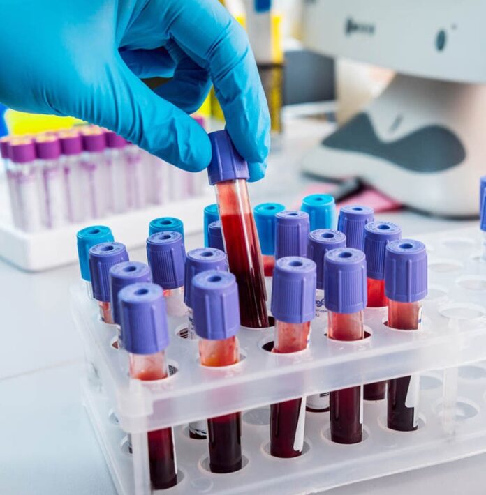 En la sangre se pueden encontrar pistas para conocer estado de salud