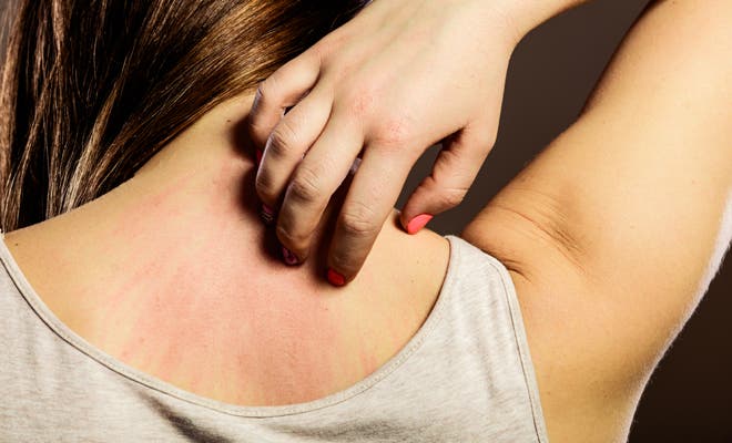 Alergia