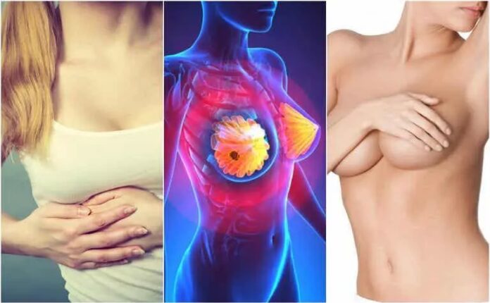 Avances en el tratamiento del cáncer de mama