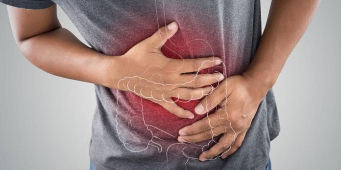 Alertan sobre aumento de cáncer de colon en jóvenes menores de 50 años 