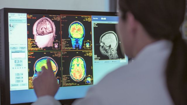Doctora mira radiografías del cerebro.