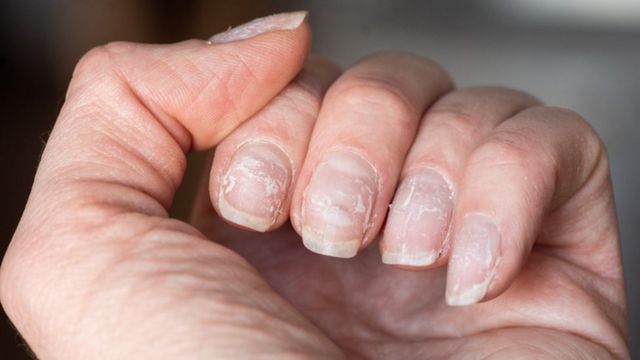 Uñas blancas