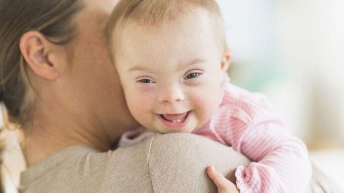 La drástica caída de nacimientos de bebés con síndrome de Down en Europa