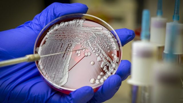 Las bacterias se cultivan en el laboratorio.