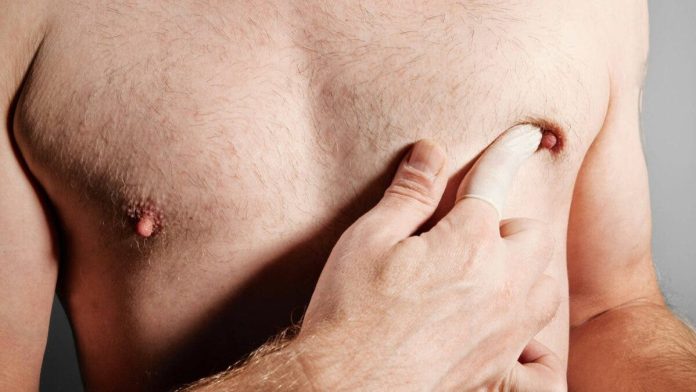 El autoexamen de mama en los hombres: una herramienta para prevenir el cáncer