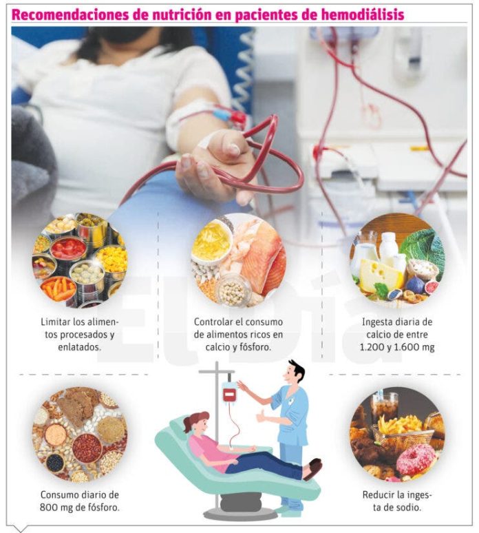 Nutrición de hemodiálisis: un desafío vital para la salud y supervivencia